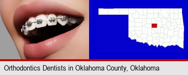 orthodontic braces; Oklahoma County highlighted in red on a map