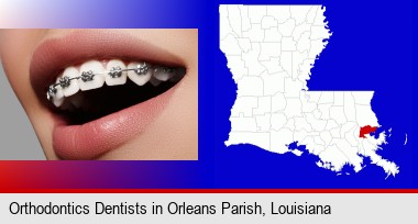 orthodontic braces; Orleans Parish highlighted in red on a map