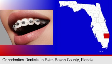orthodontic braces; Palm Beach County highlighted in red on a map