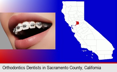 orthodontic braces; Sacramento County highlighted in red on a map