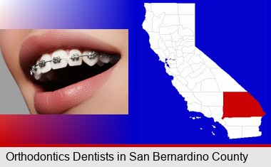 orthodontic braces; San Bernardino County highlighted in red on a map