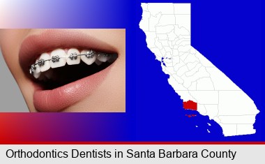 orthodontic braces; Santa Barbara County highlighted in red on a map