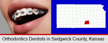 orthodontic braces; Sedgwick County highlighted in red on a map