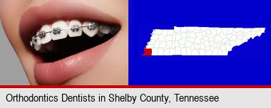 orthodontic braces; Shelby County highlighted in red on a map