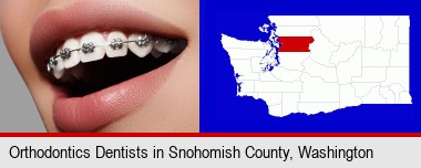 orthodontic braces; Snohomish County highlighted in red on a map