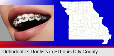 orthodontic braces; St Louis City highlighted in red on a map