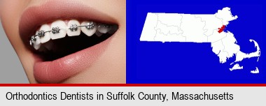 orthodontic braces; Suffolk County highlighted in red on a map