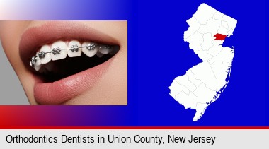 orthodontic braces; Union County highlighted in red on a map