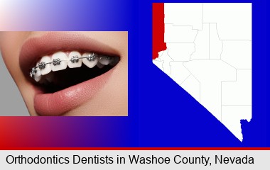 orthodontic braces; Washoe County highlighted in red on a map