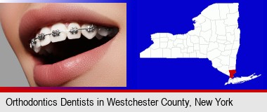 orthodontic braces; Westchester County highlighted in red on a map
